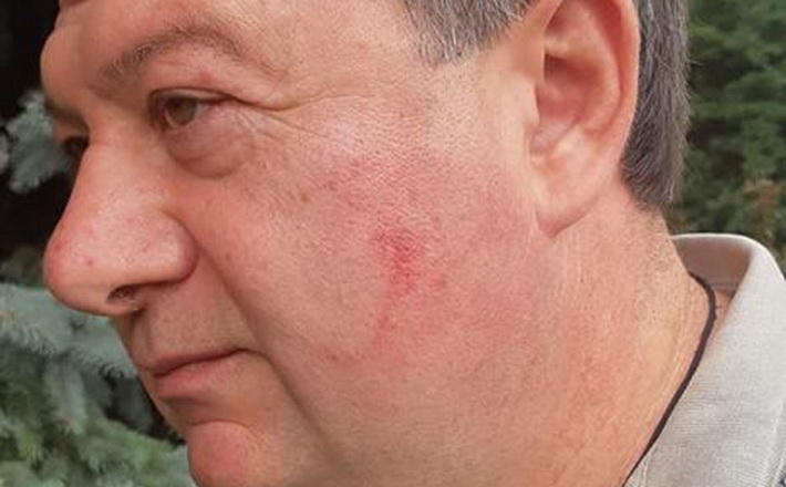 Через нібито побиття Радуцький звернувся до поліції