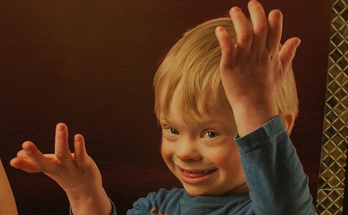 Сонячний хлопчик, який впав із черкаської дамби, вже два місяці бореться за життя