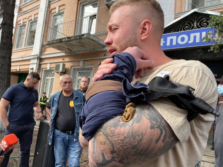 Порізав руку у знак протесту: Дмитро Кухарчук виступає проти дій президента (ВІДЕО)