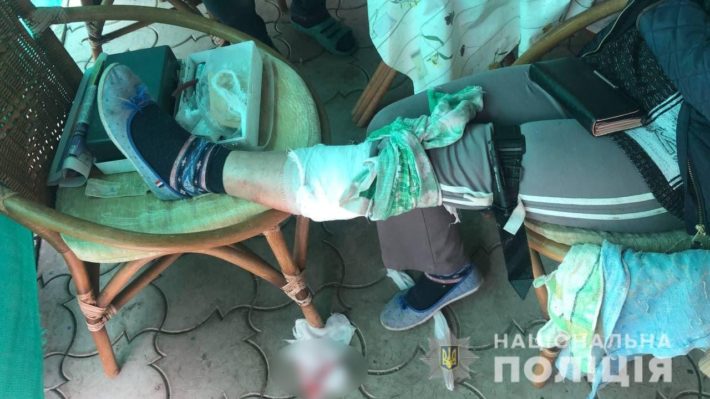 На Черкащині чоловік прострелив ногу дружині через ревнощі