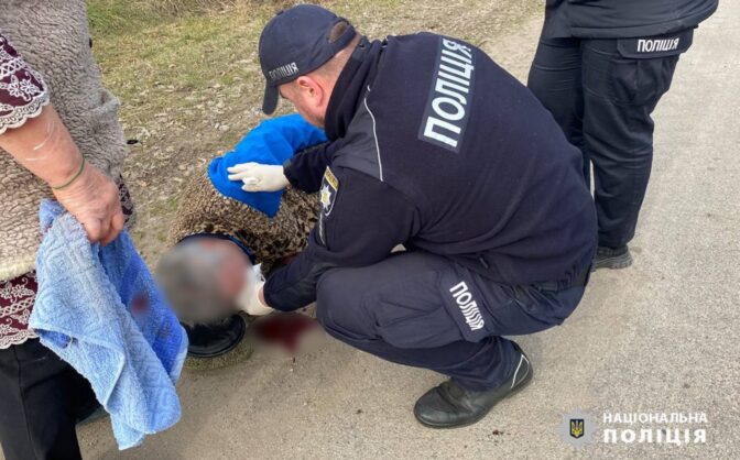 Упав і розбив обличчя: на Черкащині правоохоронці врятували людину, якій стало зле (ФОТО)