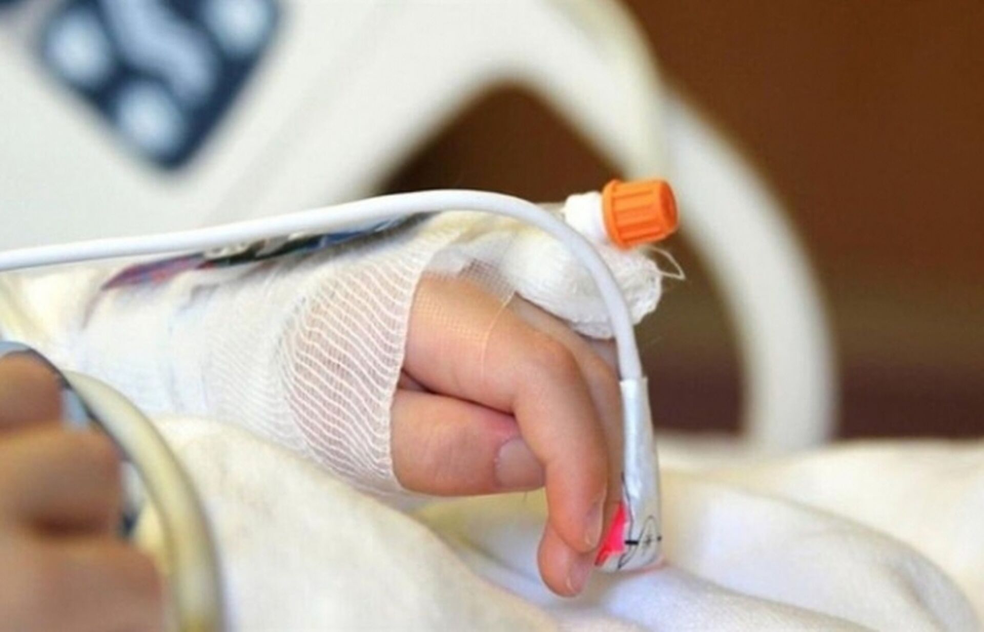 Під час пожежі черкащанка отримала опіки, її госпіталізували