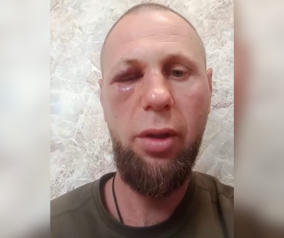 На побиття ветерана війни в Смілі відреагував Арахамія