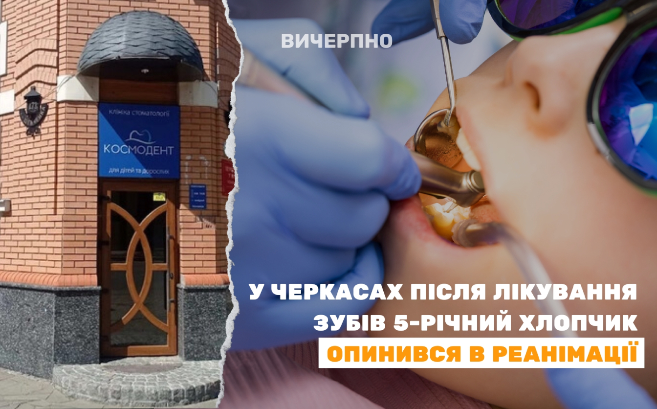 У Черкасах після лікування зубів 5-річний хлопчик опинився в реанімації (ФОТО)