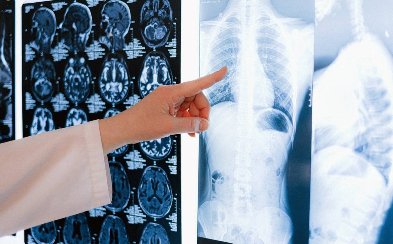 У яких випадках призначають цифровий рентген: особливості методу діагностики