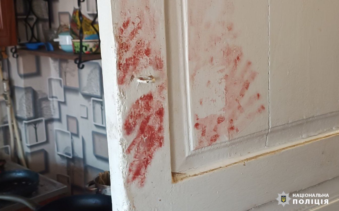 Троє жителів Сміли напали на учасника бойових дій АТО в його будинку (ФОТО)