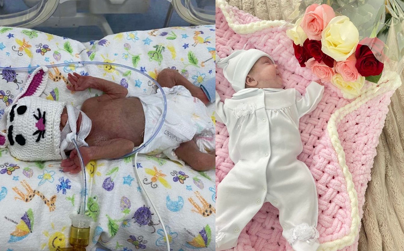 Черкаські медики виходили немовля, яке народилося з вагою 650 грамів