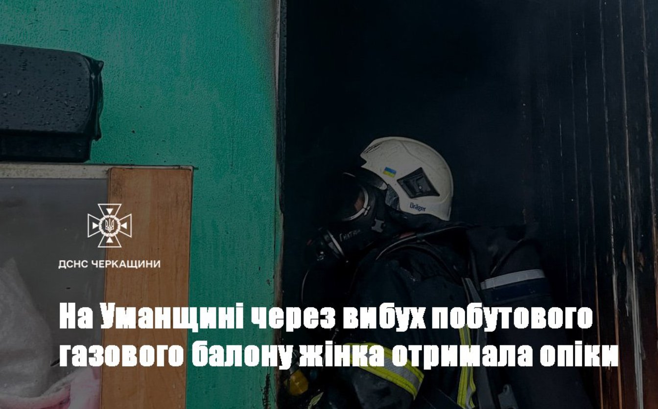 Через вибух газового балона уманчанка отримала опіки