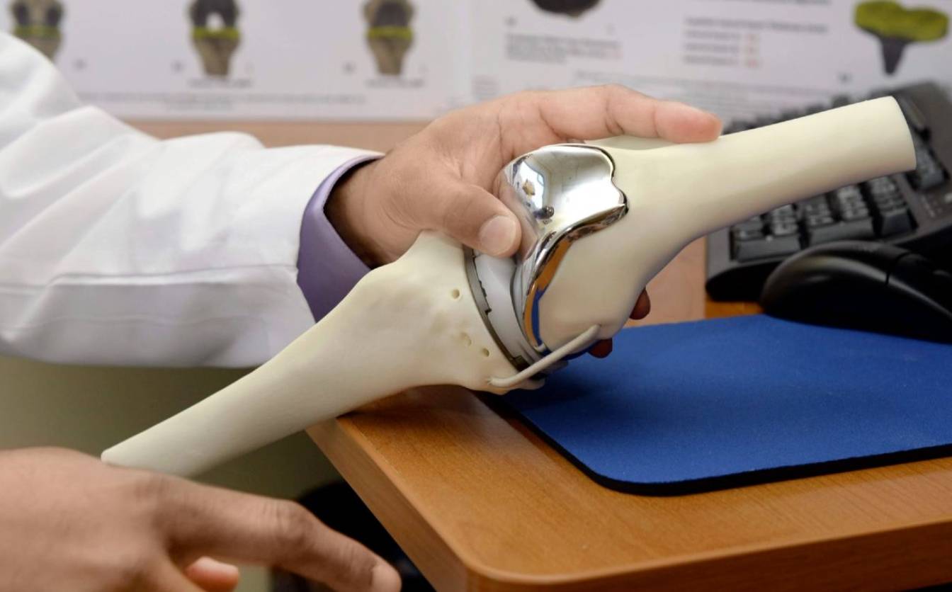 У Черкаській обласній лікарні працює електронна черга з ендопротезування