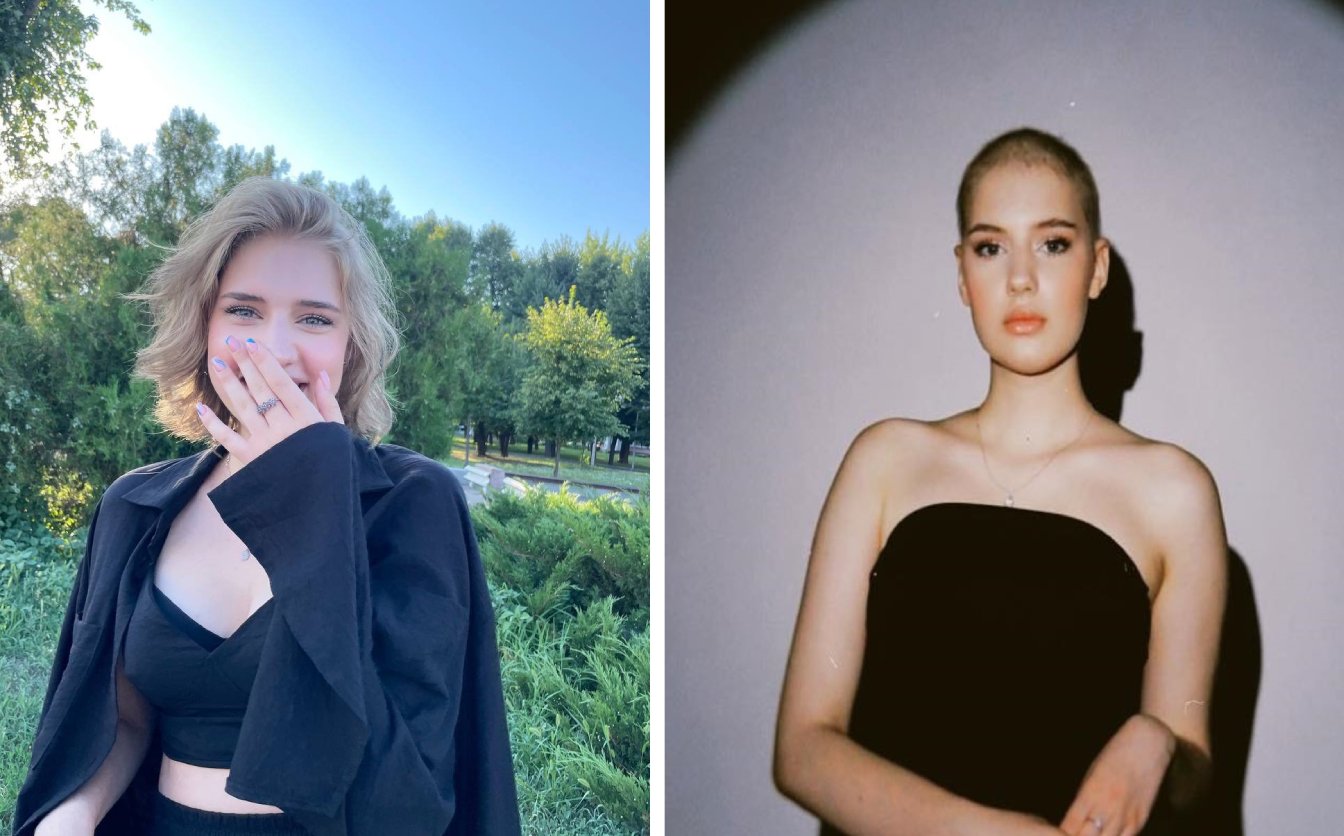 Черкаська студентка потребує лікування від лімфоми Годжкіна