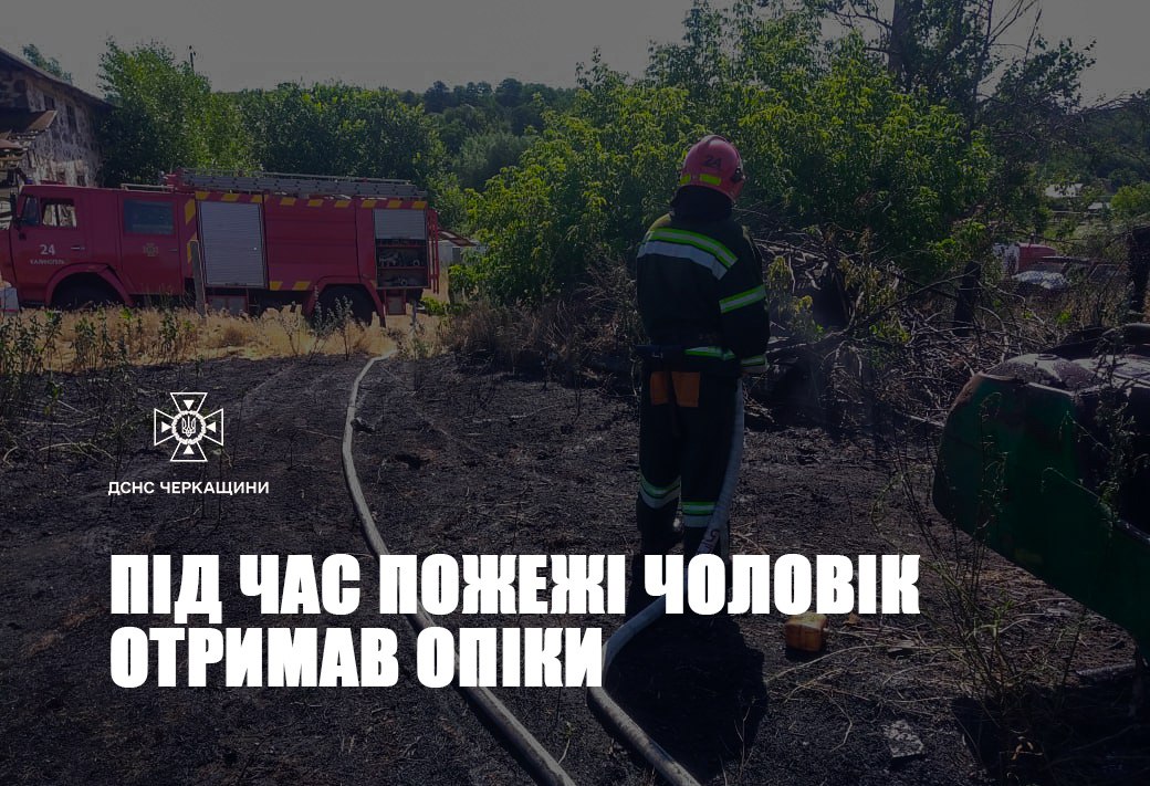 Під час пожежі черкащанин отримав опіки