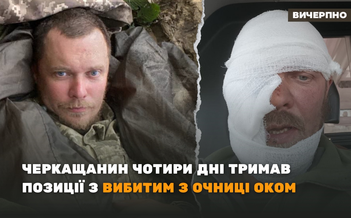 “Чотири дні сам тримав позиції з вибитим з очниці оком”: історія захисника з Черкащини (ФОТО, ВІДЕО)
