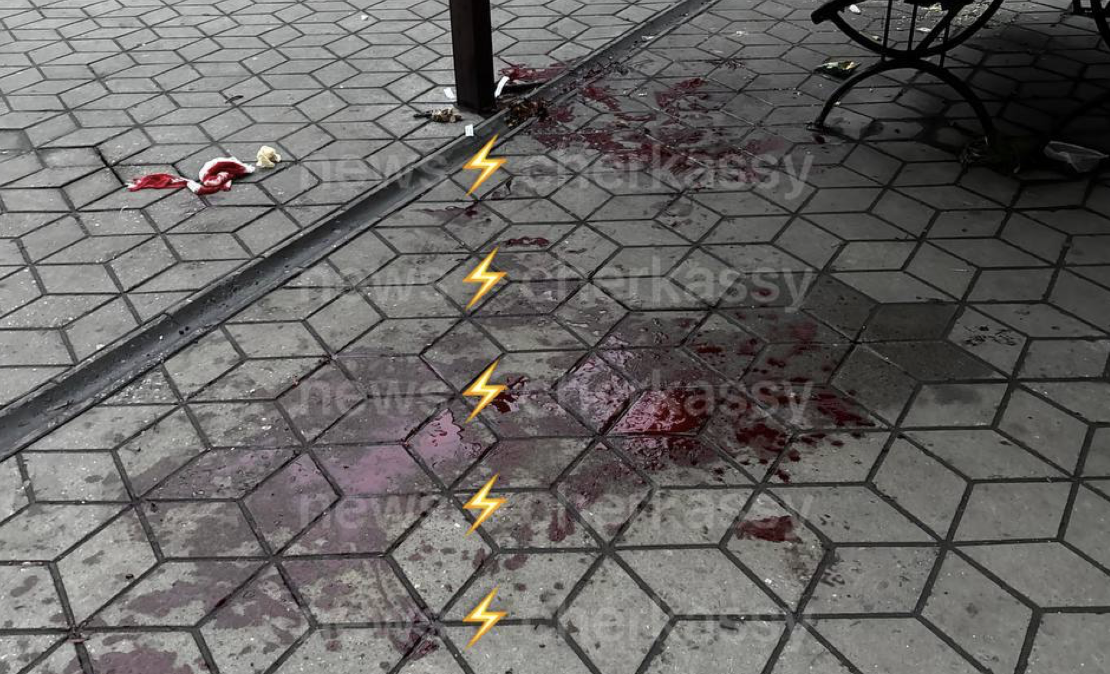 У Черкасах на зупинці громадського транспорту, ймовірно, побили чоловіка