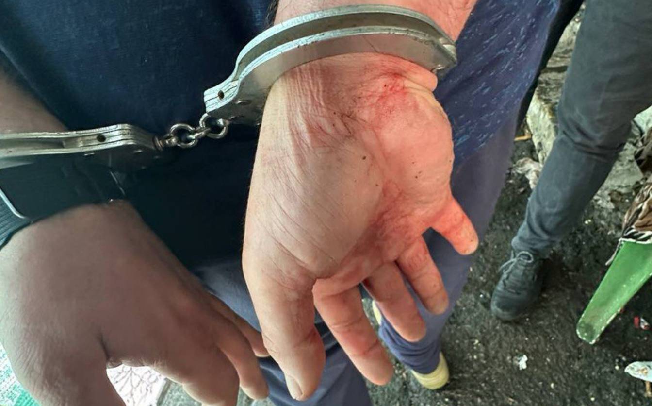 Ударив жінку ножем у спину: у Черкасах затримали 42-річного чоловіка