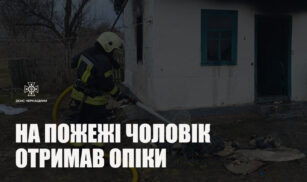 На Золотоніщині в пожежі травмувався чоловік