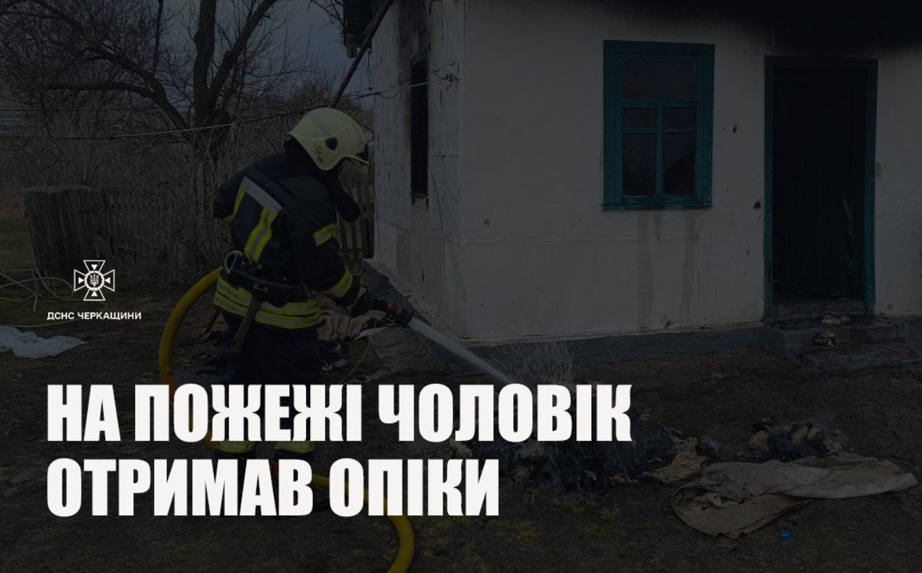 На Золотоніщині в пожежі травмувався чоловік